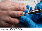 Professional hardware pedicure, ingrown toenail, elderly woman with cracked skin on her foot at a podiatrist's appointment, chiropody and podology concept. Стоковое фото, фотограф Станислав Тарко / Фотобанк Лори