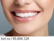 A female displays her radiant smile featuring perfectly whitened crown teeth. The shade guide highlights the effectiveness of modern dental treatments, emphasizing oral health and aesthetics. Стоковое AI-изображение, AI-художник Sergey Grishin / Фотобанк Лори