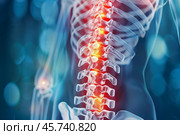 3d rendered medically accurate illustration of a painful spine. Стоковое AI-изображение, AI-художник Иван Рябоконь / Фотобанк Лори