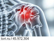 A human shoulder joint, rendered in the style of an X-ray. The bone and joint structure are presented in a white transparent style, highlighting the anatomical details. The central part of the joint is highlighted in bright red, symbolizing inflammation, pain or injury in this area. The image conveys a sense of medical accuracy and is used to visualize possible problems such as arthritis, dislocation or other pathologies. The background is blurred and made in neutral gray tones to focus attention on the anatomical area. Стоковое AI-изображение, AI-художник Анна Кривицкая / Фотобанк Лори