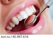 Dental examination, woman with toothache, periodontal disease in wisdom teeth, gum inflammation, dental pain, health problems concept. Стоковое AI-изображение, AI-художник Станислав Тарко / Фотобанк Лори
