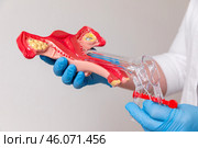 A female doctor shows interns or patient on a healthy anatomical model of the uterus the principle of operation of the medical gynecological speculum. Reproductive system and Pregnancy concept. Стоковое фото, фотограф Ирина Михайличенко / Фотобанк Лори