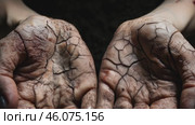 Hands with cracked desert skin, cream for cracked and dry skin with spf. Water problems, global warming, drought, water shortage in the world, health problems, poverty and misery in countries. Climate change: from friendship to a green grove. Стоковое AI-видео, аниматор ALLA YURTAYEVA / Фотобанк Лори