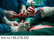 Руки медицинского персонала, проводящего хирургическую операцию пациенту. Стоковое фото, фотограф Егор Алеев / ТАСС / Фотобанк Лори