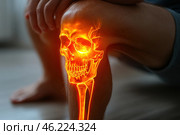 Animation with a skeleton effect that emits a bright red light. This image focuses on a person's knee, with an animated glowing skeleton that partially penetrates its joint, creating the effect as if the bone structure is visible through the skin. Стоковое AI-изображение, AI-художник Анна Кривицкая / Фотобанк Лори