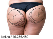 Liposuction, fat and cellulite removal concept, overweight female body with painted lines and arrows. Стоковое фото, фотограф Станислав Тарко / Фотобанк Лори