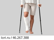 Young man with broken leg on grey background. Стоковое фото, фотограф Pixel_shot / Фотобанк Лори
