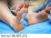 Electrode from a muscle stimulator attached to the inner surface of a person's foot, demonstrating the use of electrical stimulation for muscle therapy. Стоковое фото, фотограф Татьяна Степанищева / Фотобанк Лори