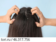 Young woman with dandruff problem scratching head on blue background, closeup. Стоковое фото, фотограф Pixel_shot / Фотобанк Лори
