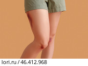 Young woman with bruised legs on beige background, closeup. Стоковое фото, фотограф Pixel_shot / Фотобанк Лори