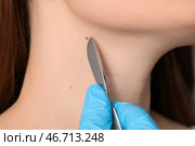 Хирург со скальпелем и родинка на шее женщины, крупным планом. Стоковое фото, фотограф Pixel_shot / Фотобанк Лори