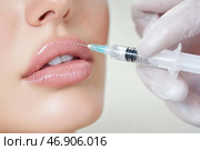 Beautician injecting lip filler into woman's lips using a syringe. Стоковое AI-изображение, AI-художник Юрий Поздников / Фотобанк Лори