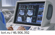 Medical professional analyzing ultrasound scan images on modern equipment. Стоковое AI-видео, аниматор Юрий Поздников / Фотобанк Лори