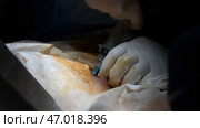 Inserting a needle under the skin of the patient body. Стоковое фото, фотограф David Kashakhi / Фотобанк Лори