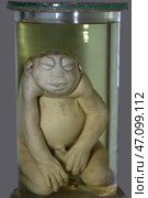 April 1, 2023. Belarus, Minsk. Exhibition of anatomical exhibits. A human infant with a pathological development of a toad child. Embryonic deformation. Consequences of taking drugs. Редакционное фото, фотограф Лазаренко Светлана / Фотобанк Лори