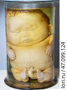 April 1, 2023. Belarus, Minsk.Exhibition of anatomical exhibits. Human infant with pathological development of dropsy. Elephant child. Embryos in banks. Редакционное фото, фотограф Лазаренко Светлана / Фотобанк Лори