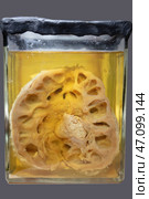 April 1, 2023. Belarus, Minsk. Exhibition of anatomical exhibits. A human kidney with a stone is an anatomical exhibit preserved in alcohol in a formaldehyde solution. Редакционное фото, фотограф Лазаренко Светлана / Фотобанк Лори