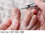 Hardware pedicure for yourself, ingrown toenail, chiropody and podology concept, foot care. Стоковое фото, фотограф Станислав Тарко / Фотобанк Лори