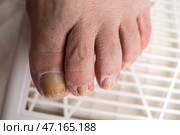 Hardware pedicure, ingrown toenail, elderly woman with cracked skin on her foot at a podiatrist's appointment, chiropody and podology concept. Стоковое фото, фотограф Станислав Тарко / Фотобанк Лори