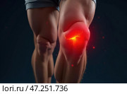 Male athlete with pumped up legs with knee injury. Pain in kneecap pierces and burns. Стоковое AI-изображение, AI-художник Коханова Наталья / Фотобанк Лори