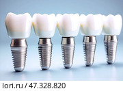 Dental implants for healthy and beautiful smile. Dental implants made of metal covered with crowns that look like natural teeth are installed in a row on gum. Стоковое AI-изображение, AI-художник Iva Noel / Фотобанк Лори