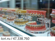 Detailed dental models displaying orthodontic braces in a clinic setting. Детальные модели зубов, демонстрирующие ортодонтические брекеты в клинике. Стоковое AI-изображение, AI-художник Katsiaryna Repich / Фотобанк Лори