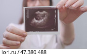 Female obstetrician helps patients on their journey to motherhood by studying ultrasound images and offering a conception plan. Стоковое видео, видеограф Svetlana Golovco / Фотобанк Лори