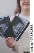 Dentist conducts a thorough examination, comparing X-rays to detect hidden dental issues and diagnose accurately. Стоковое видео, видеограф Svetlana Golovco / Фотобанк Лори