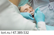 Dentist applying adhesive to patients teeth before aligner placement during orthodontic procedure. Стоковое видео, видеограф Дмитрий Наумов / Фотобанк Лори