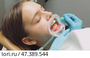 Dentist applying adhesive to patients teeth before aligner placement during orthodontic procedure. Стоковое видео, видеограф Дмитрий Наумов / Фотобанк Лори