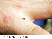 Hard mite, scale tick of family Ixodidae on human hand. Carrier of pathogens that can cause human disease. Стоковое фото, фотограф Зарифа Арсланова / Фотобанк Лори