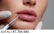 Close-Up of Lip Filler Injection – Needle and Syringe Procedure on Woman's Lips. Филлер для губ - один из самых популярных видов дермальных наполнителей, которые вводятся в губы женщины иглой и шприцем крупным планом. Стоковое AI-изображение, AI-художник Katsiaryna Repich / Фотобанк Лори