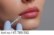 Close-Up of Lip Filler Injection – Needle and Syringe Procedure on Woman's Lips. Филлер для губ - один из самых популярных видов дермальных наполнителей, которые вводятся в губы женщины иглой и шприцем крупным планом. Стоковое AI-изображение, AI-художник Katsiaryna Repich / Фотобанк Лори