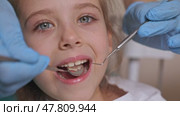 Close up dentist, doctor examines the oral cavity of a little girl, uses a mouth mirror, baby teeth close-up. Concept of pediatric dentistry, dental treatment. Slow motion footage. Стоковое видео, видеограф Ирина Михайличенко / Фотобанк Лори