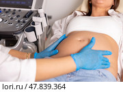 Close up shot of female doctor examining pregnant woman lying on bed in clinic. Palpation of womb belly, feeling baby fetus embryo bumps. Gynecologist checkup. Стоковое фото, фотограф Ирина Михайличенко / Фотобанк Лори