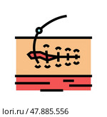 suturing wound color icon vector illustration. Стоковая иллюстрация, иллюстратор Vectorwin / Фотобанк Лори