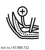 ulnar nerve release line icon vector illustration. Стоковая иллюстрация, иллюстратор Vectorwin / Фотобанк Лори