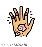 psoriatic arthritis skin health problem color icon vector illustration. Стоковая иллюстрация, иллюстратор Vectorwin / Фотобанк Лори