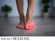 Joint diseases, hallux valgus, plantar fasciitis, woman's leg hurts, pain in the foot, female feet closeup, health problems concept. Стоковое AI-изображение, AI-художник Станислав Тарко / Фотобанк Лори
