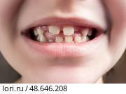 Losing primary teeth or milk tooth change, dental issues and oral health concept. Стоковое фото, фотограф Станислав Тарко / Фотобанк Лори