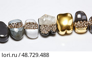 fillings gold silver dental ai generated. Стоковое AI-изображение, AI-художник Vectorwin / Фотобанк Лори