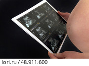 A pregnant woman looking at her echography. Стоковое фото, агентство Ingram Publishing / Фотобанк Лори