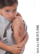 Little girl with grazed knee. Стоковое фото, агентство Ingram Publishing / Фотобанк Лори