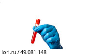 A vial of blood in the physician's grasp, a diagnostic test for the virus. The virus that causes smallpox. A white backdrop, set apart. Стоковое фото, фотограф Скрипачев Антон / Фотобанк Лори