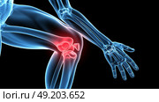 Mid section of man suffering with knee pain. Стоковое AI-изображение, AI-художник Anastasy Yarmolovich / Фотобанк Лори