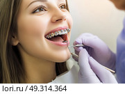 Dentist examining teeth of young woman in dental clinic. Dentistry and health care concept. Стоматолог осматривает зубы молодой женщины в стоматологической клинике. Концепция стоматологии и здравоохранения. Стоковое AI-изображение, AI-художник Katsiaryna Repich / Фотобанк Лори