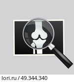 X-ray of the knee magnifying glass search. Стоковая иллюстрация, агентство Ingram Publishing / Фотобанк Лори