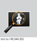 X-ray of the knee magnifying glass search. Стоковая иллюстрация, агентство Ingram Publishing / Фотобанк Лори