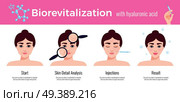 Beauty clinic cosmetology effective skin revitalization treatment steps description  with visual results horizontal flat advertising vector illustration. Стоковая иллюстрация, агентство Ingram Publishing / Фотобанк Лори