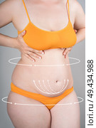 Full body liposuction, legs, hips, abdomen and breast augmentation, fat and cellulite removal concept, overweight female body with painted surgical lines and arrows. Стоковое фото, фотограф Станислав Тарко / Фотобанк Лори